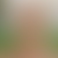 blog-details